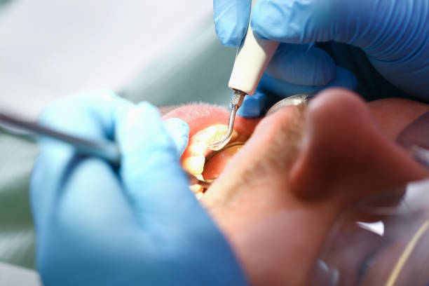 Best Emergency Denture Repair in Silver Creek, NY